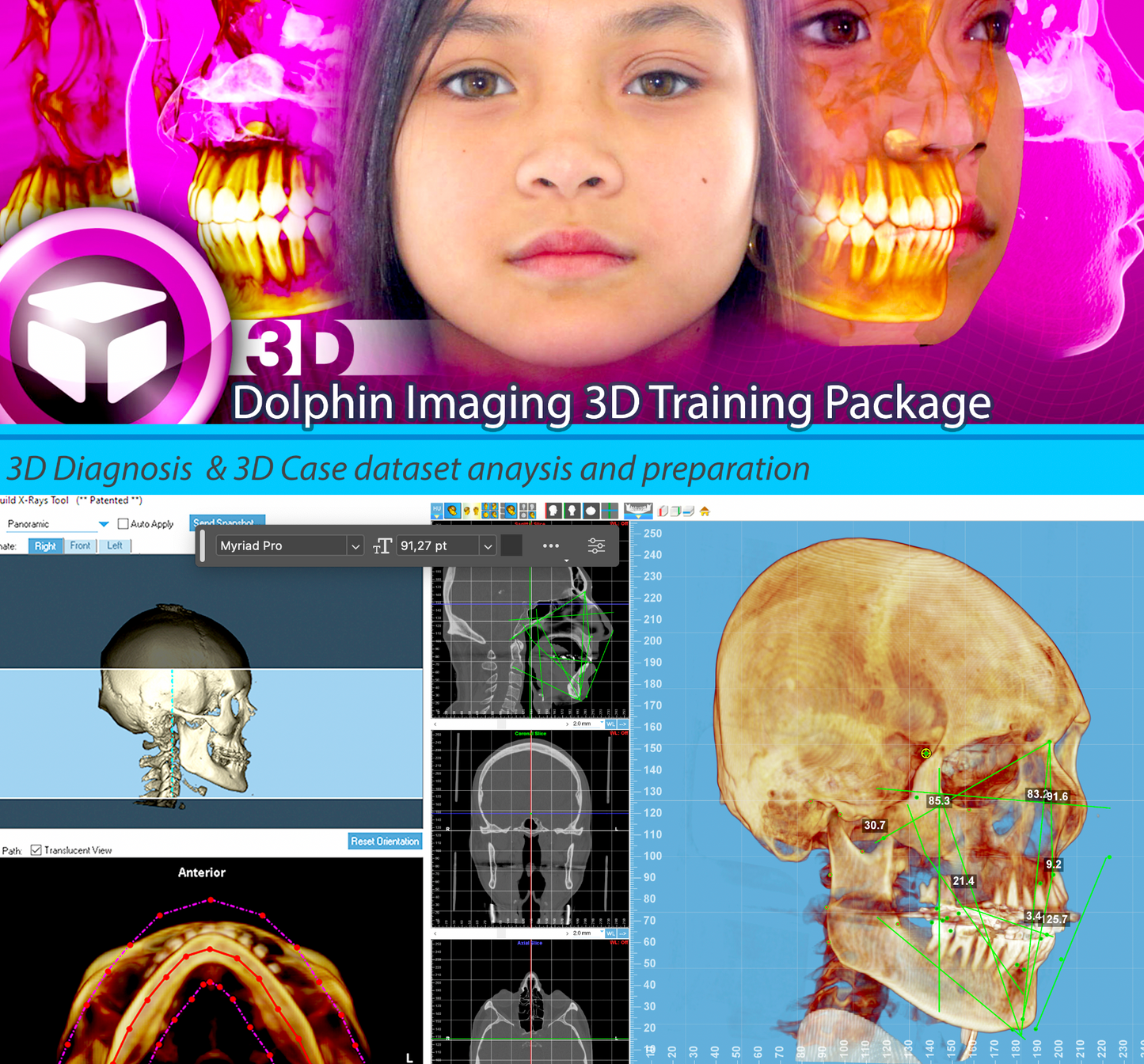 4Hrs DolphinImaging 3D Online Training
