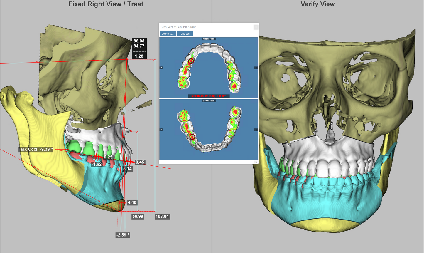 Dolphin Imaging  3D & 3D Surgery SOLO